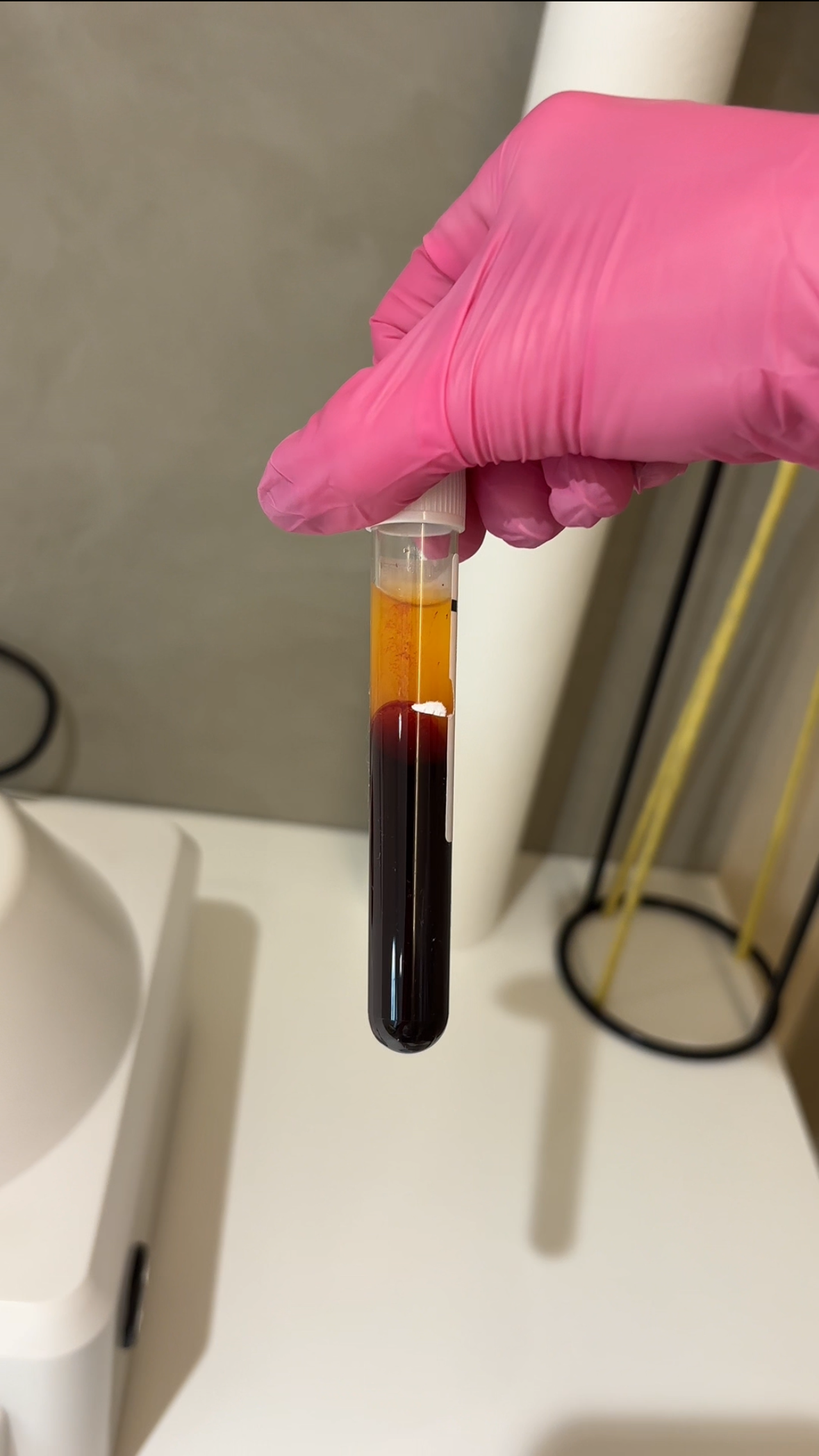 Pink-gloved hand holding a vial of blood, taken as part of the Platelet-Rich Fibrin process.