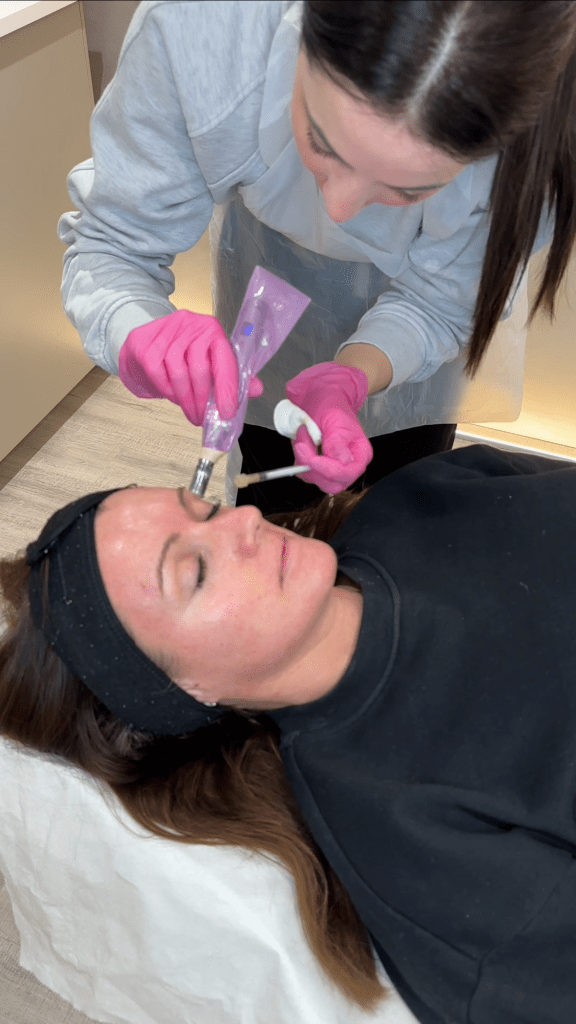 White woman, wearing dark top and dark headband, reclines with her eyes closed while Sarah, wearing an apron and pink gloves, injects Platelet-Rich Fibrin into her face.